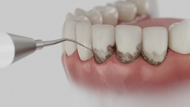 Trusted Teeth Whitening service in Cabin John, MD - Dentist Open Now